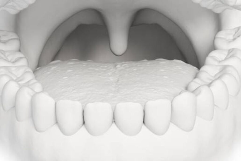 What is the Lump in the Roof of the Mouth: Causes, Symptoms, and Care